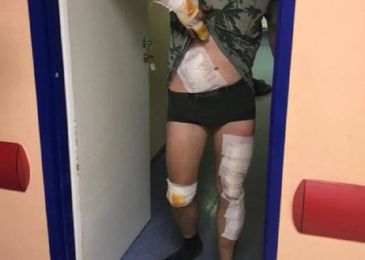 Как дорожники своей халатностью провоцируют массовые ДТП