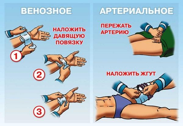 Автомобильная аптечка: состав, правила применения